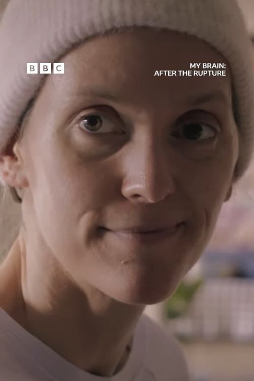 My Brain: After the Rupture 2025